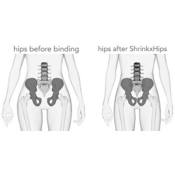 Faja UpSpring Baby Shrinkx Hips Poste Extremo Cinturón de Compresión de Natal Desnudo - XS/S